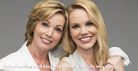 juvederm-raleigh-mother-daughter-before-after
