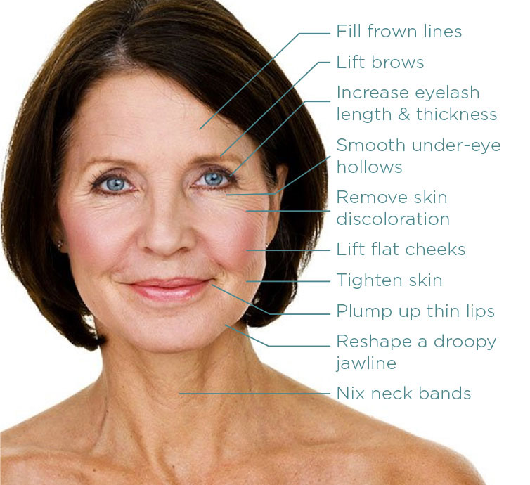 post menopause woman restylane treatment sites raleigh