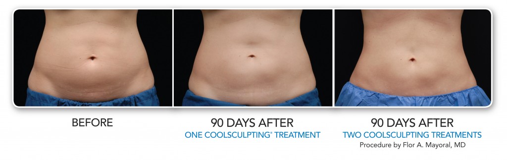 BA-Female-MultipleTreatments-002-1024x323