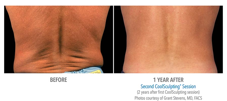 B&A-Stevens-FL-2Set-1yr-Back-LoRes