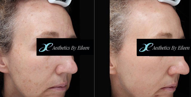 11 30 2017 16 29 00 1