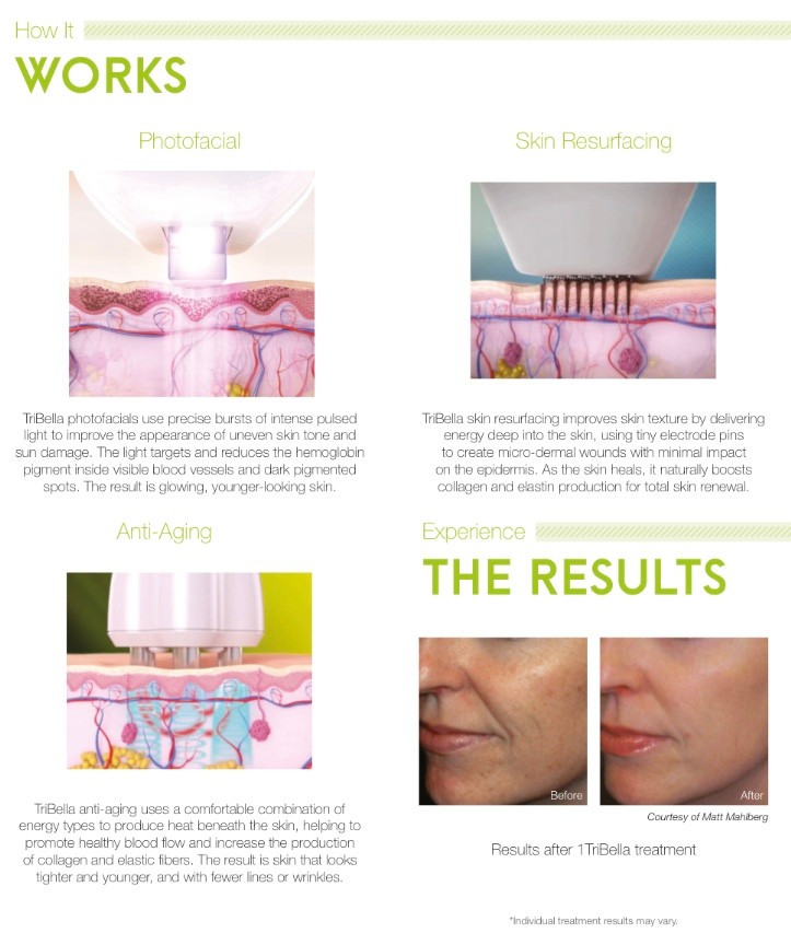 4591d0 c88e36d4ea09478c9146d56ad427234f mv2