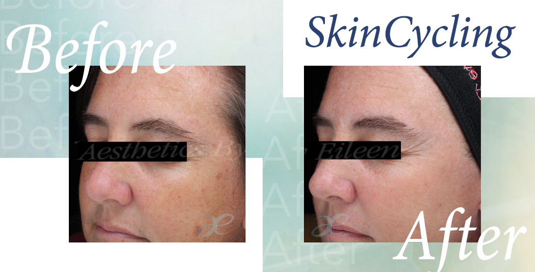 SkinCycling July 22 2