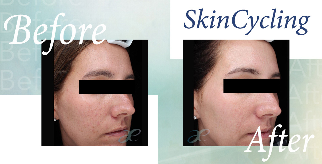 SkinCycling Sept 12 2