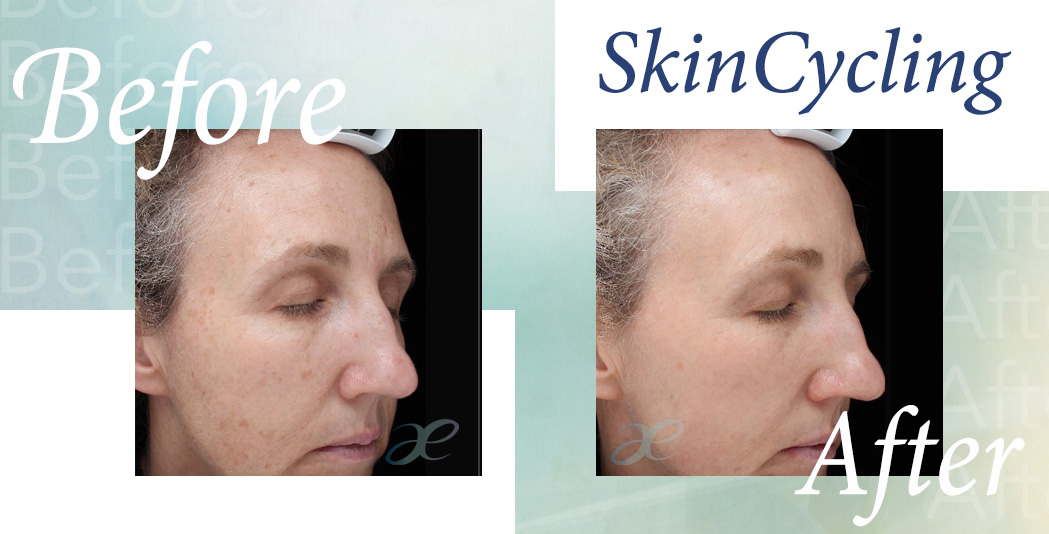 SkinCycling Sept 12 3