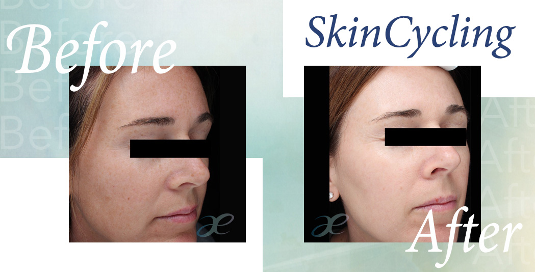 SkinCycling Sept 12 4