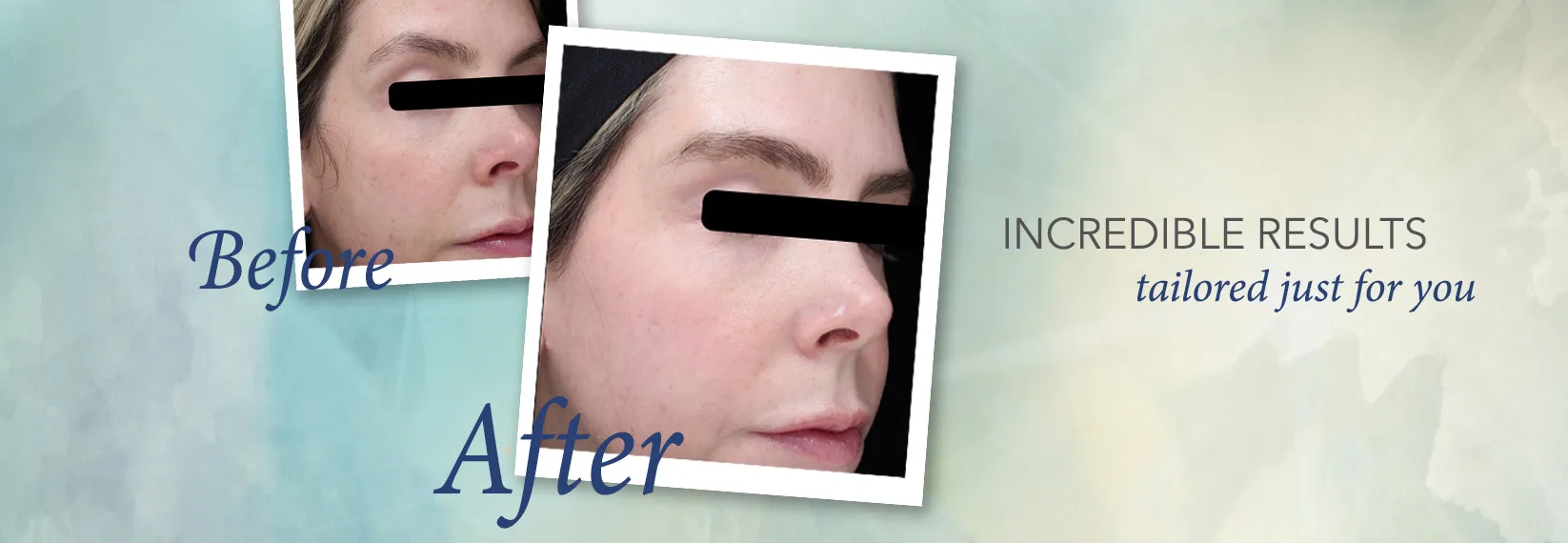 aquagold before and after