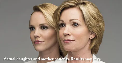 juvederm voluma raleigh mother daught before after