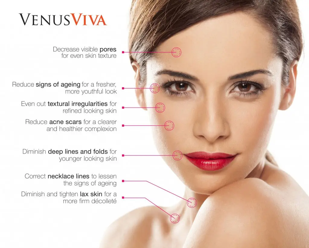 venus viva rf microneedling raleigh nc